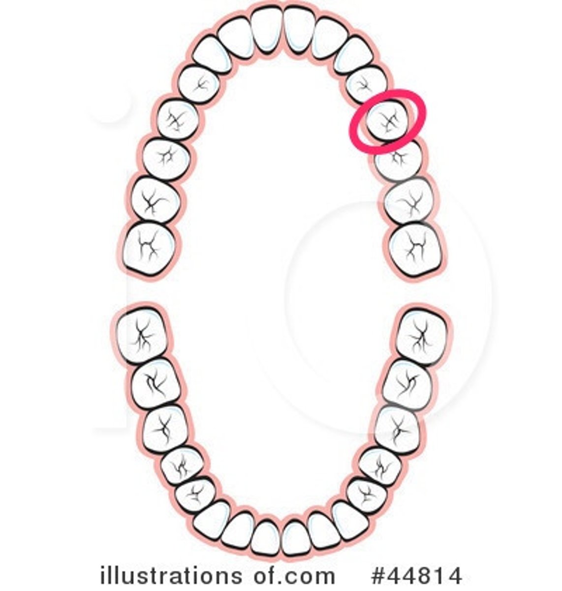 <p>UL 2nd premolar</p>