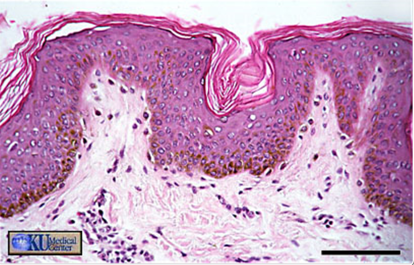 <p>is this skin from a black or white person</p>