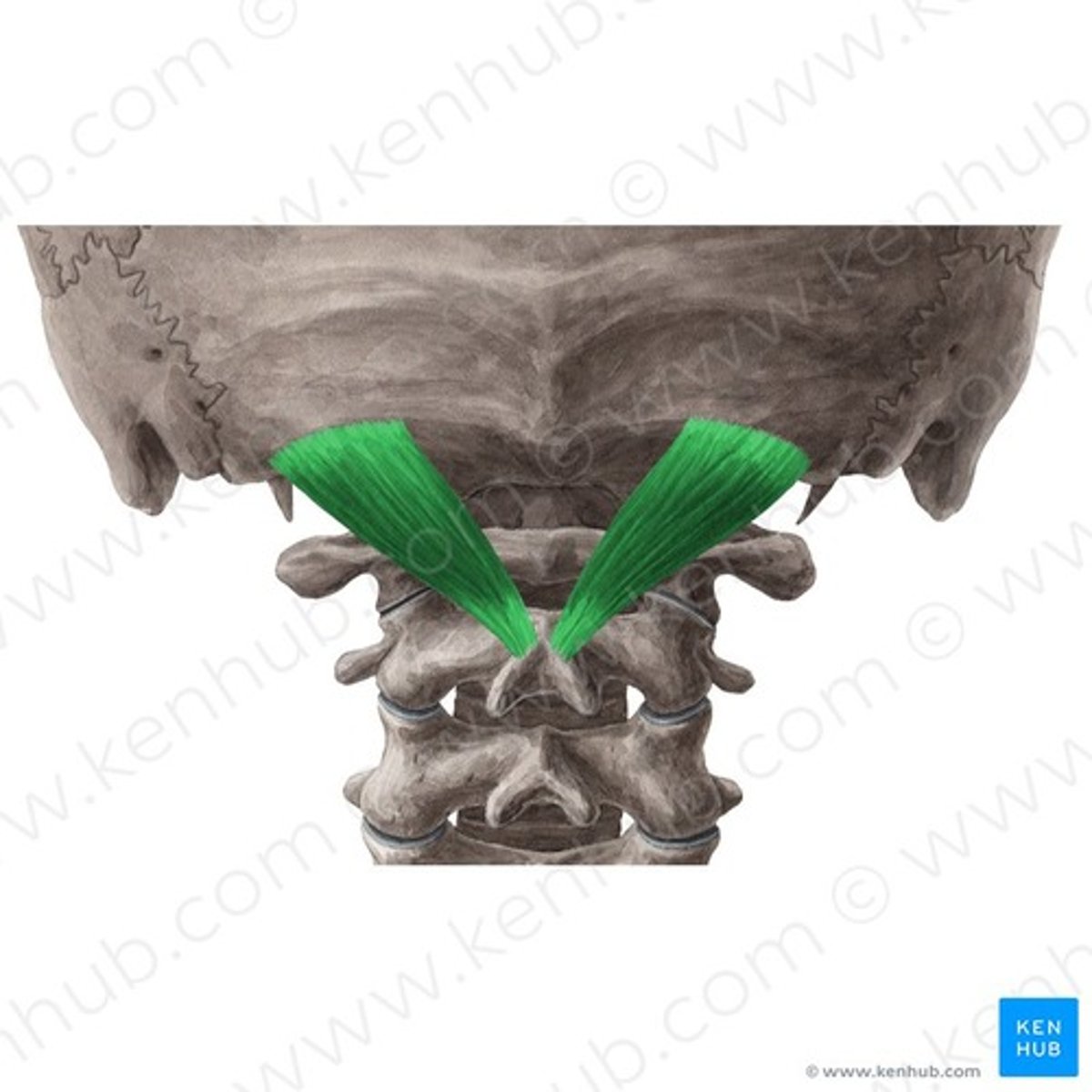 <p>Welke spier is dit?</p>