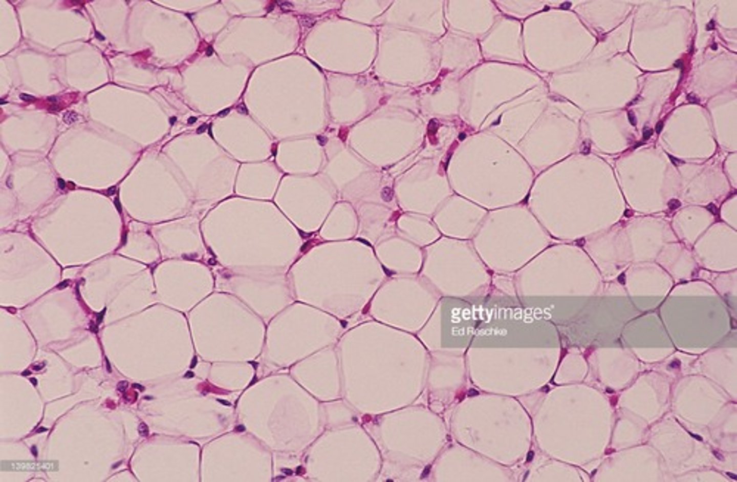 <p>Adipocyte and parts of: vacuole (stores fat),</p><p>cell</p><p>nucleus</p><p>plasma membrane</p>