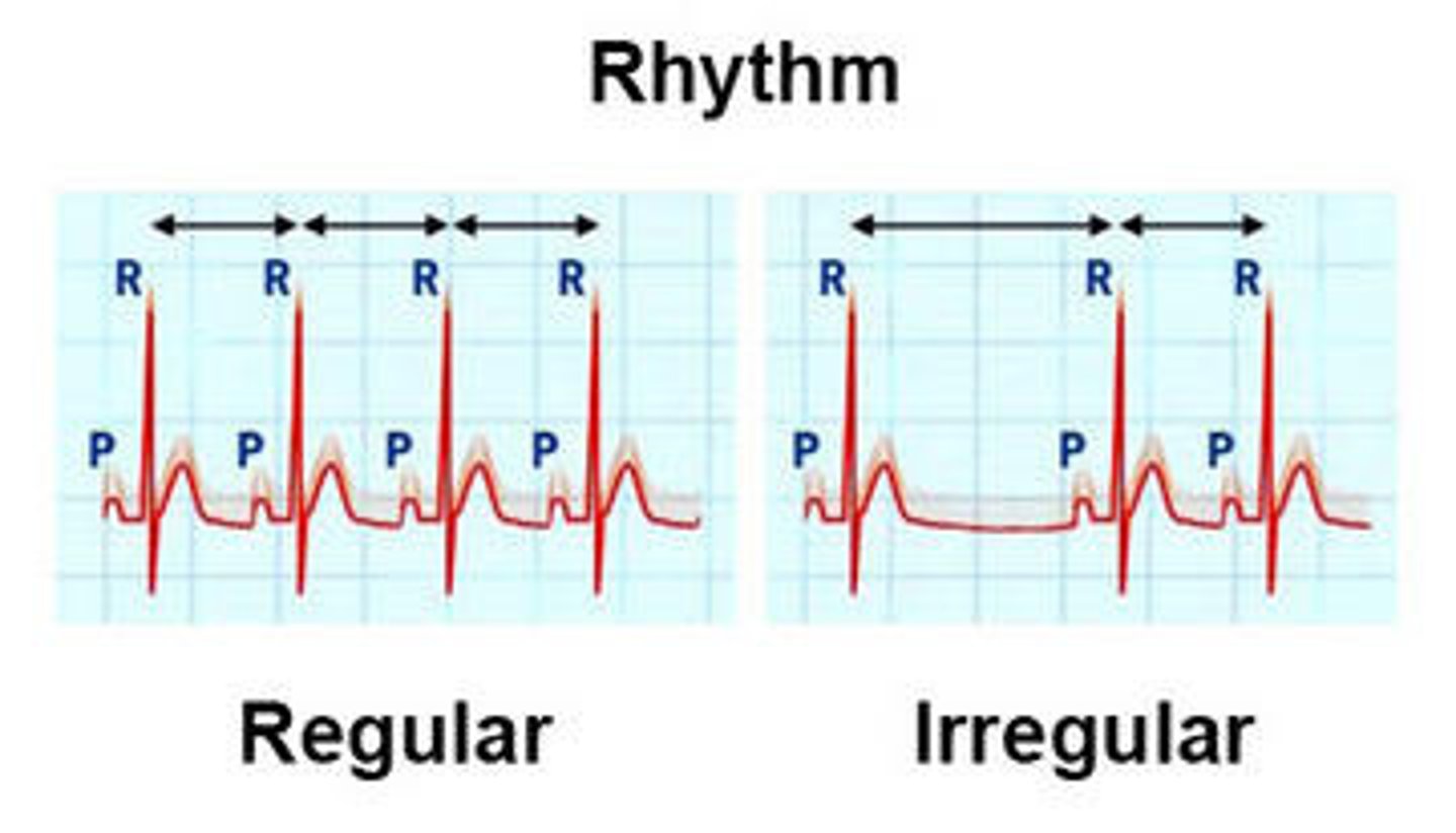 <p>Regular: same distance between similar waves forms (ex. R wave to R wave)</p><p>Irregular: different and/or irregular distance between same wave forms</p>