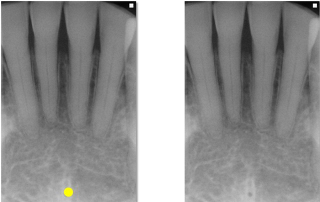 <p>what is this, its description and its appearance on images</p>