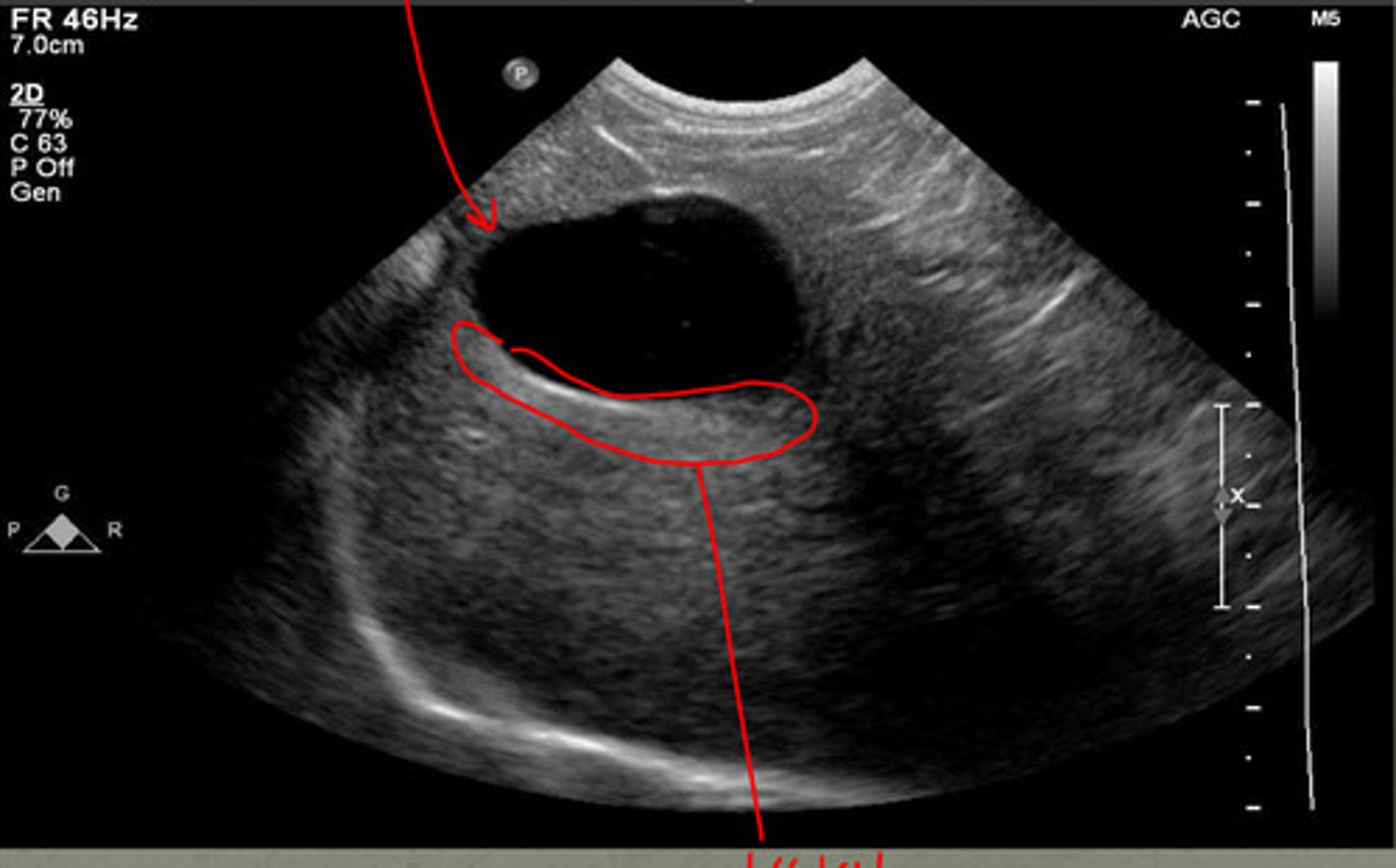 <p>if this US image was taken on the right side of the liver, what structure would this be?</p>