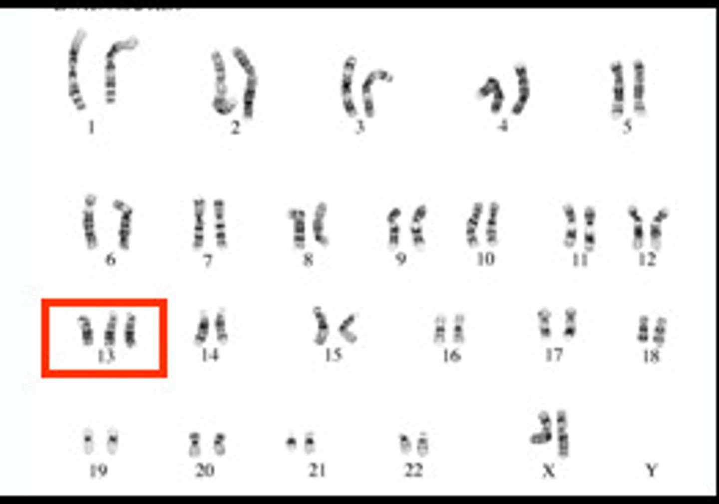<p>3 copies of a chromosome</p>