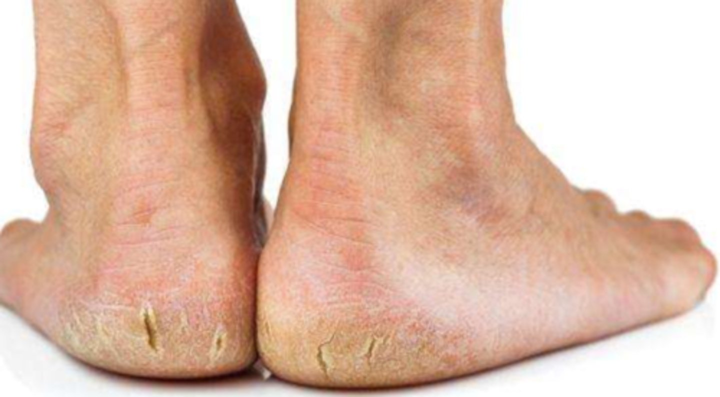 <p>¿lesión?</p><p>¿primaria o secundaria?</p>