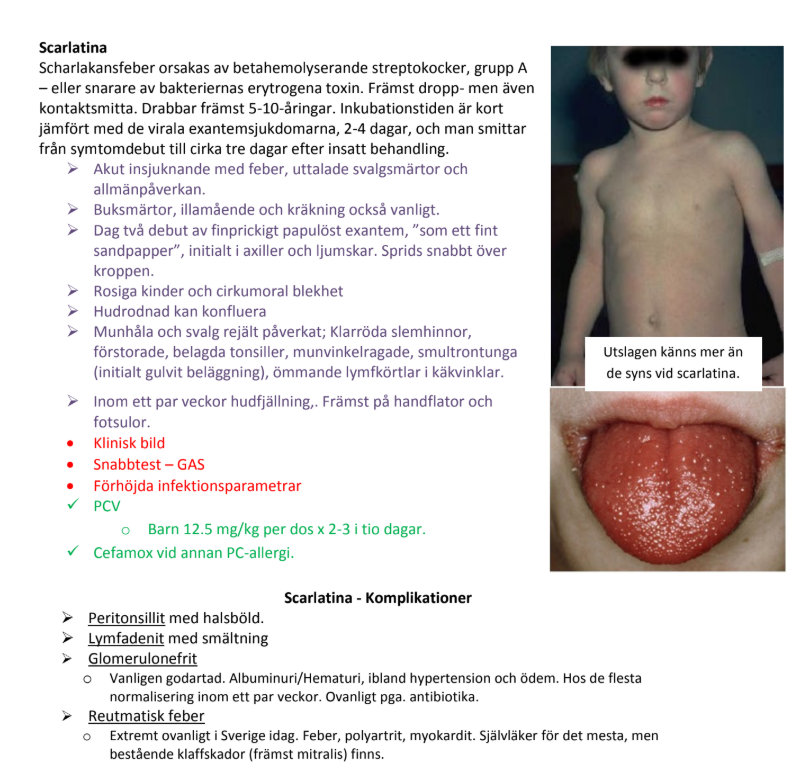 <ul><li><p><strong>Scarlatina </strong>: Orsakas av streptokocker grupp A, drabbar barn 3–8 år. Symtom: plötslig hög feber, magont, utslag (rött sandpapper), circumoral blekhet, röda tonsiller.</p></li></ul><p></p>