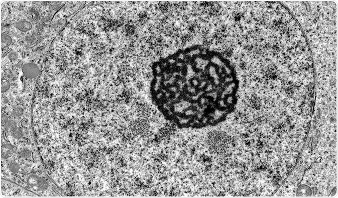 <ul><li><p>looks at the internal structure of things</p></li><li><p>black and white</p></li><li><p>higher quality that most types</p></li><li><p>utilizes electrons for imaging</p></li></ul><p></p>
