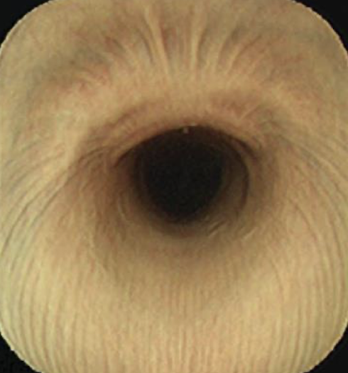 <p>What part of the esophagus is this? </p>