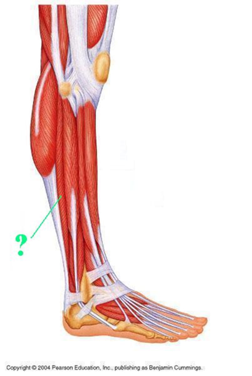 <p>Identify the indicated muscle</p>
