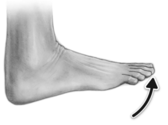 <p>What type of joint movement is this? </p>