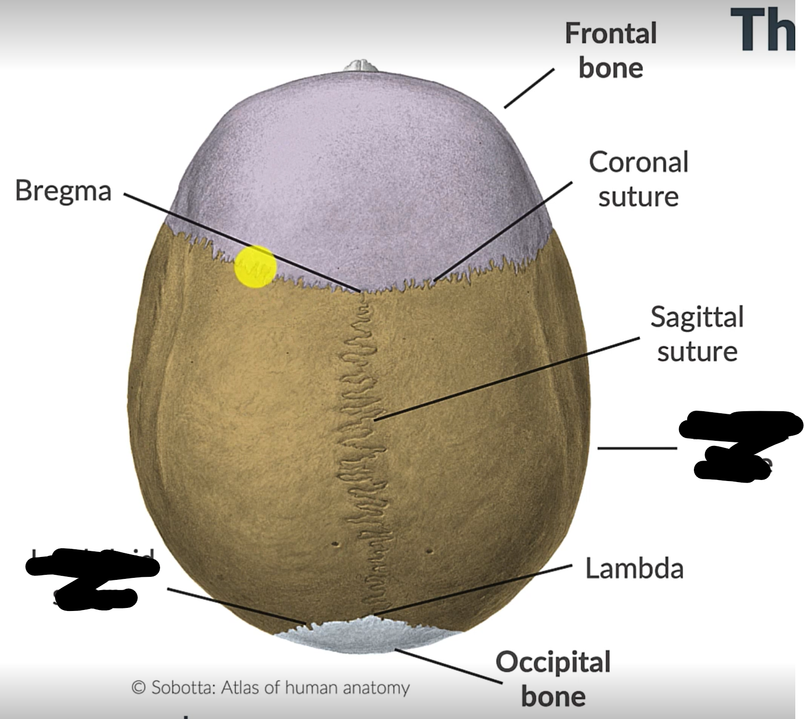 term image