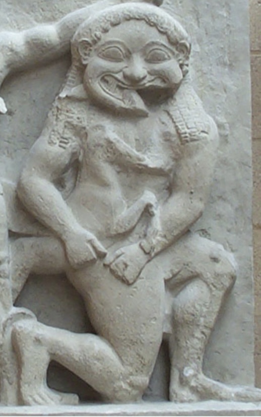 <p>How is detail created in the figure of medusa? (2 Points)</p>