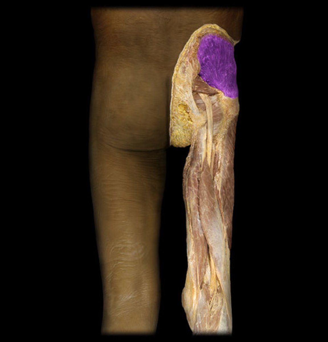 <p>Origin: Ilium external surface</p><p>Insertion: Greater trochanter</p>