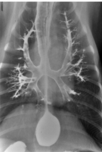 <p>Where are the lobes in a DV radiograph</p>