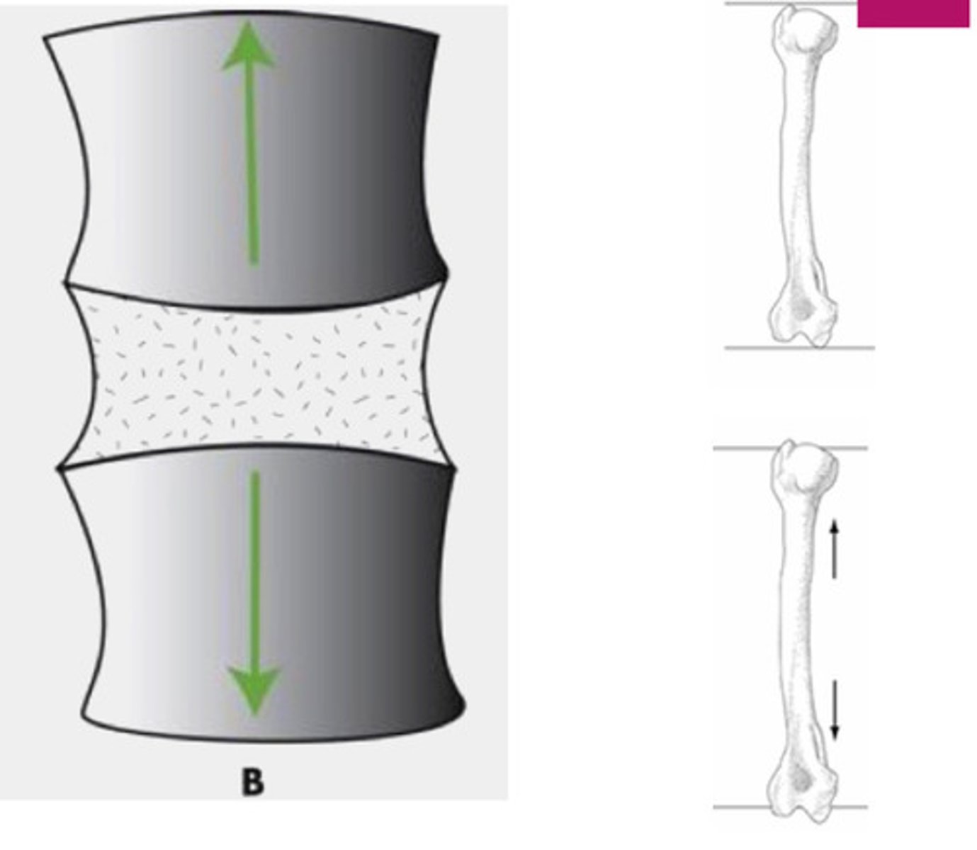 <p>Force applied in perpendicular directions, pulls tissues apart; occurs as a joint moves as the tendon transfers force from muscle tissue to bone</p>
