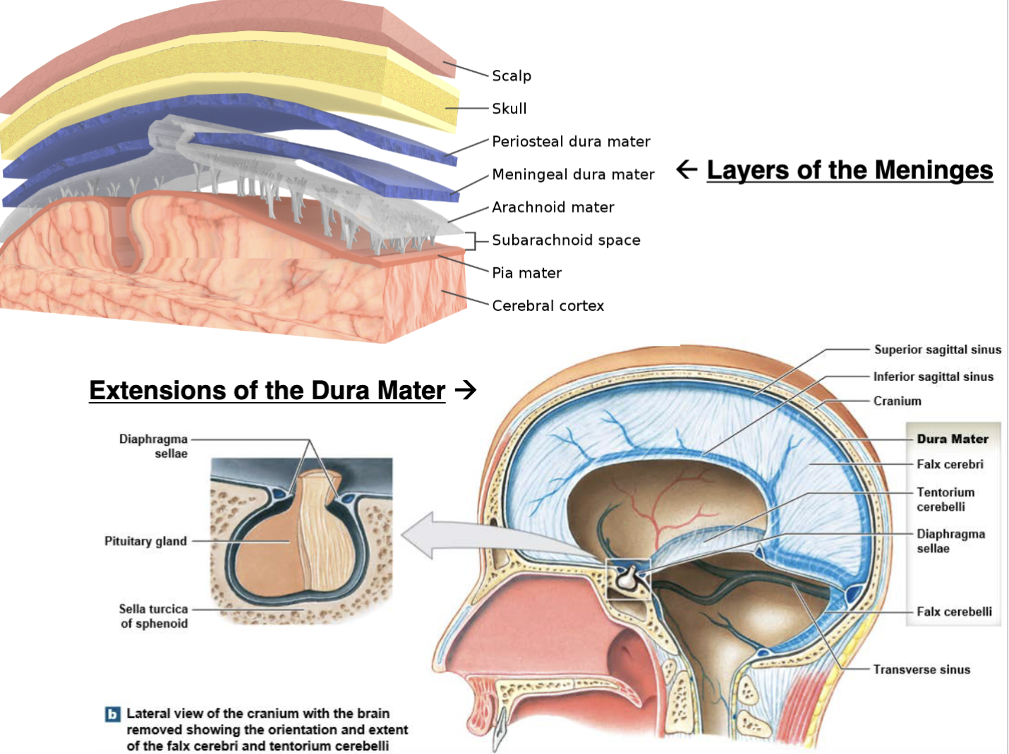 <p>• Meninges surround brain &amp; spinal cord; 3 layers<br></p><p><mark data-color="blue">• dura mater: </mark>most superficial; 2 layers<br>• thicker, <u>outer </u><strong><u>periosteal </u></strong>layer –<br>attached to cranial bones<br>• thinner,<u> inner </u><strong><u>meningeal </u></strong>layer<br>• extensions of dura mater<br><strong>   • falx cerebri: </strong>separates cerebral<br>hemispheres<br><strong>   • falx cerebelli: </strong>separates<br>cerebellar hemispheres<br> <strong>  • tentorium cerebelli: </strong>separates<br>cerebellum from cerebrum’s<br>occipital lobes<br><strong>   • diaphragma sellae: </strong>lines sphenoid’s sella turcica<br></p><p><mark data-color="blue">• arachnoid mater:</mark> middle layer<br></p><p><mark data-color="blue">• pia mater: </mark>deepest layer</p>