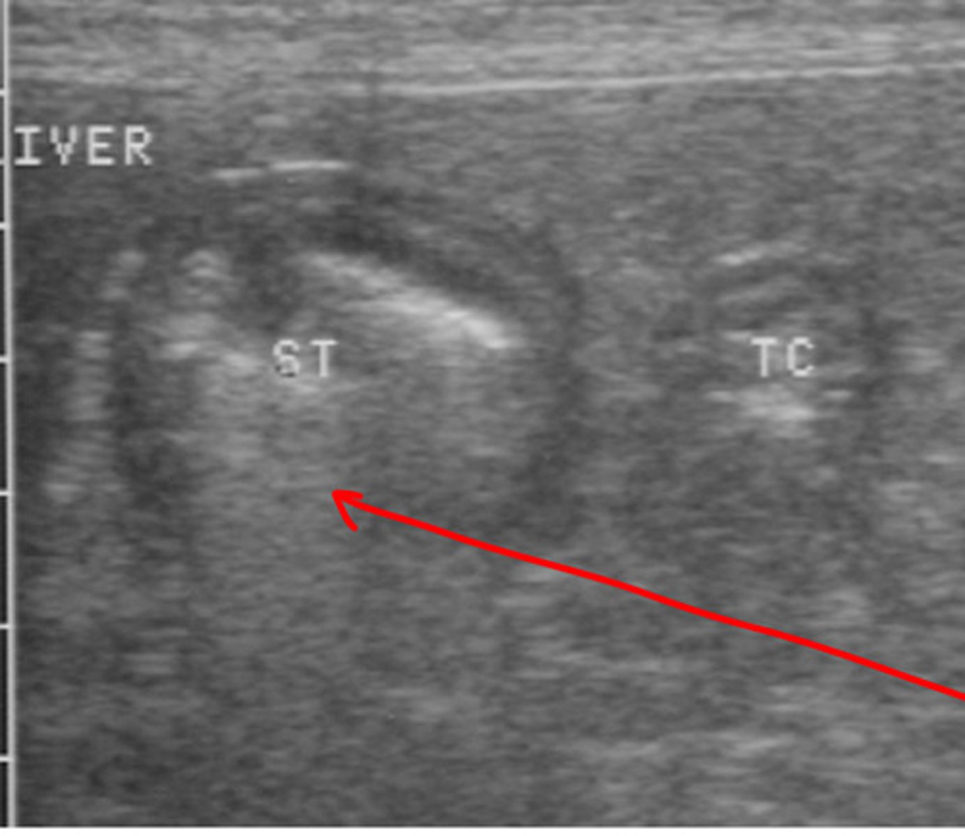 <p>what causes the streaking indicated by the arrow?</p>