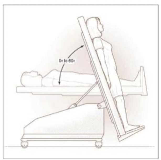 <p>What did Murialdo et al (2007) find investigating regulatory control of heart rate variability in EDs using the tilt table test?</p><ul><li><p>lie on a table that adjusts your body position from horizontal to vertical to simulate standing up</p></li><li><p>monitored changes in heart rate and blood pressure</p></li></ul><p></p>