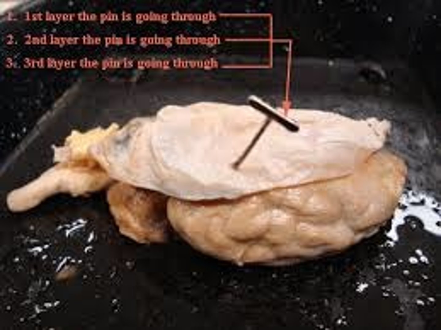 <p>dura mater, arachnoid mater, pia mater</p>