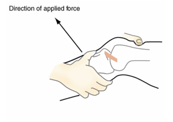special test and implication