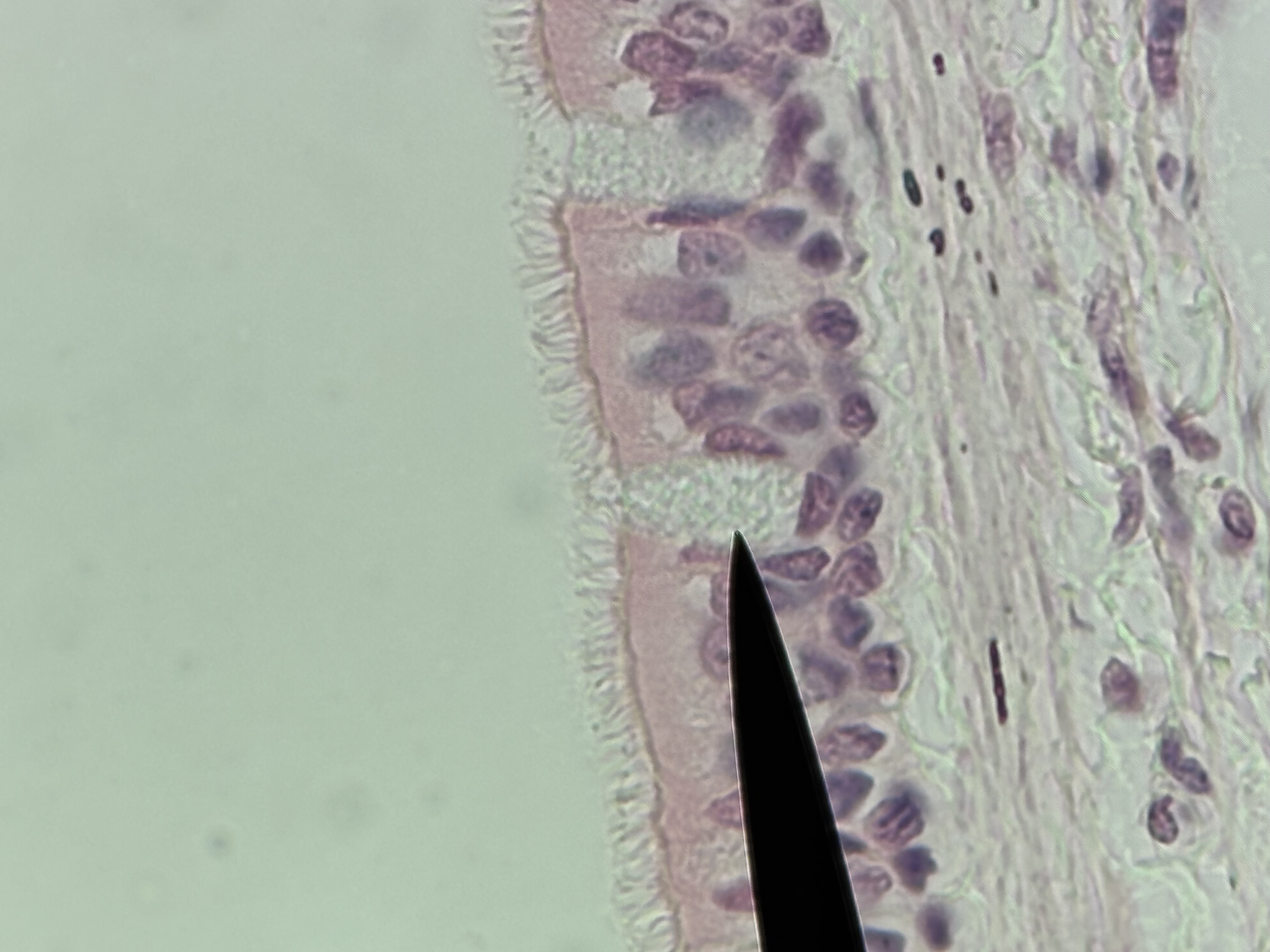 <p>Psuedostratified Ciliated Columnar ET with goblet cells</p>