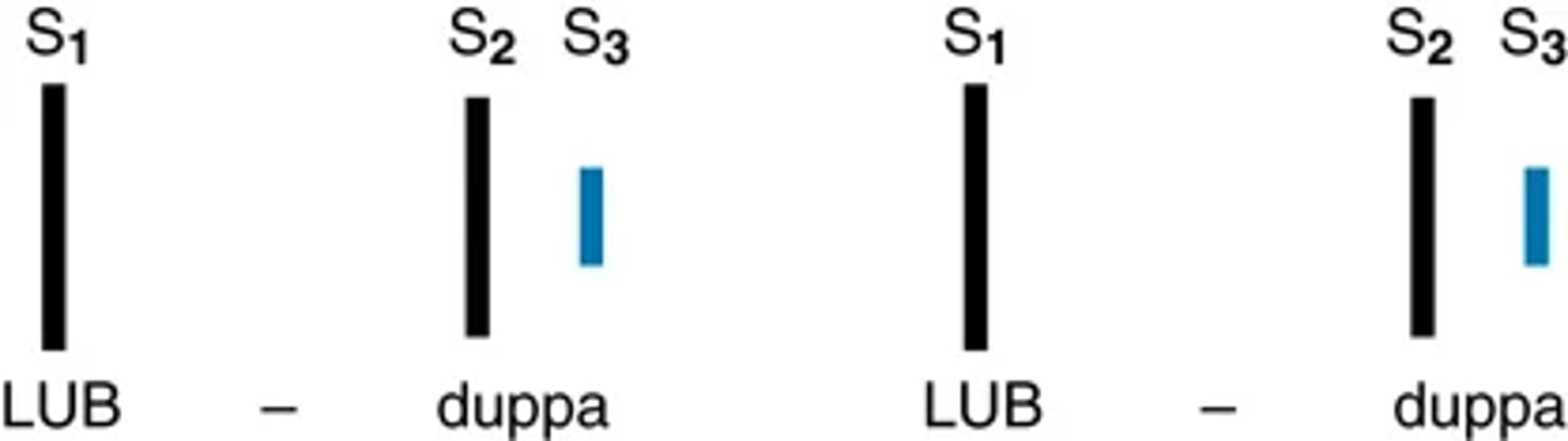 <p>An iatrogenic sound, the opening of a ball-in-cage mitral prosthesis gives an early diastolic sound: an opening click just after S2. It is loud, heard over the whole precordium, and loudest at the apex and left lower sternal border.</p>