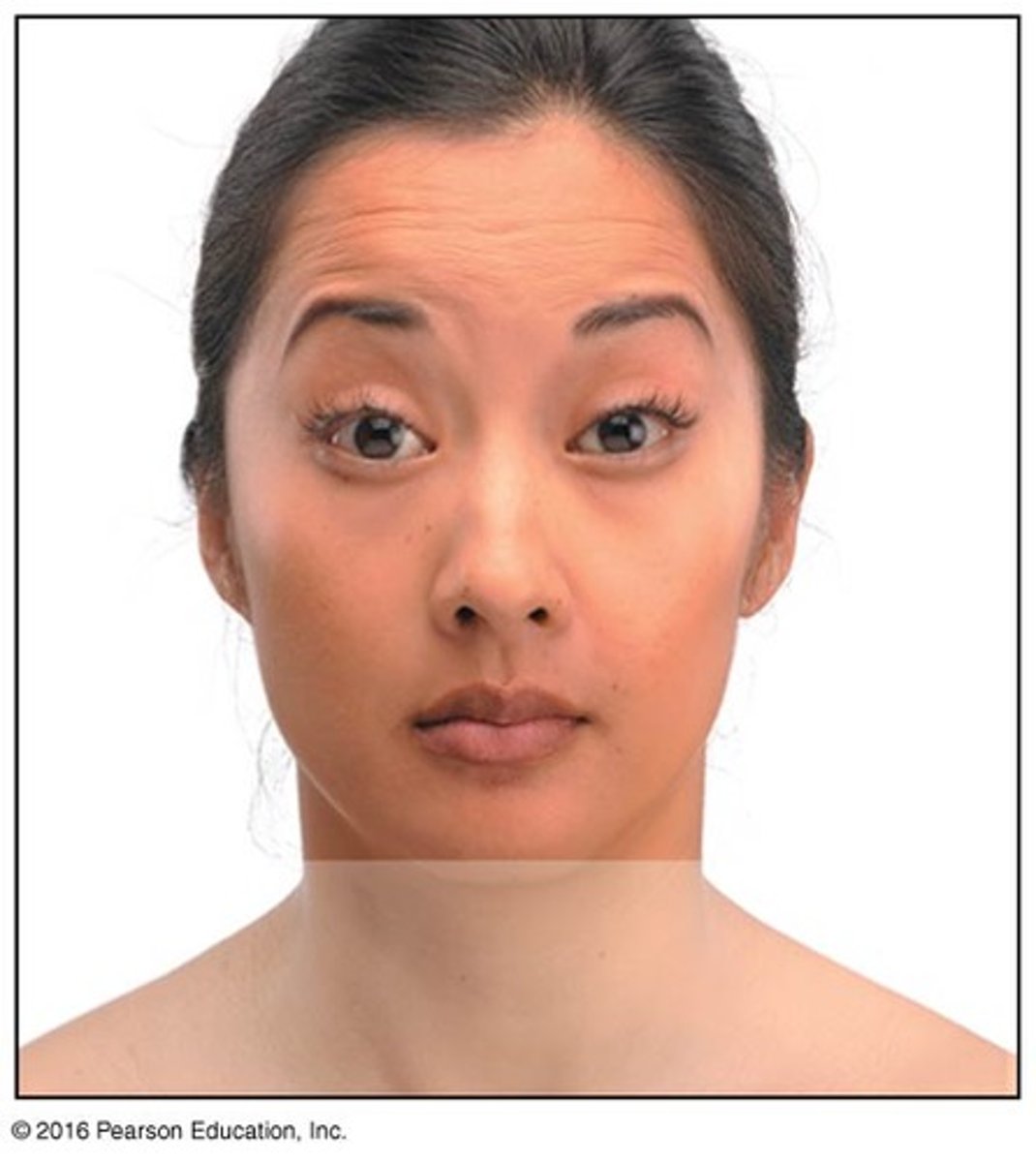 <p>surprise; raises eyebrows, wrinkles skin of forehead</p>