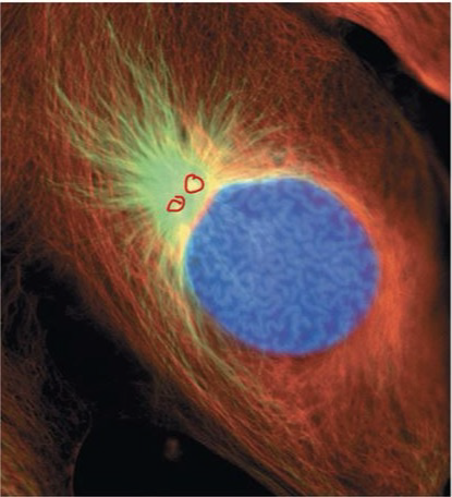 <p>Prophase</p>