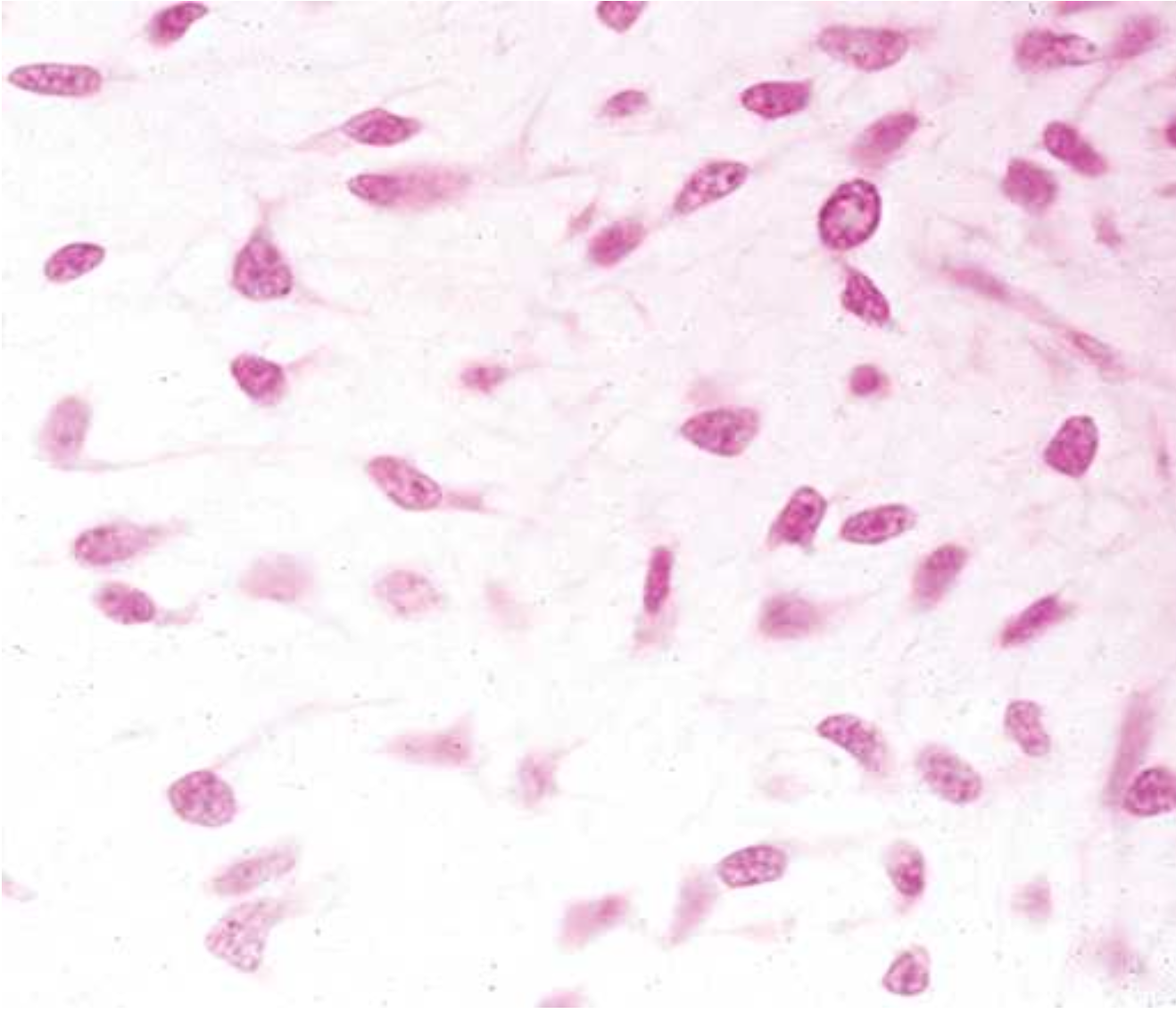 <p>What is mesenchyme?</p>