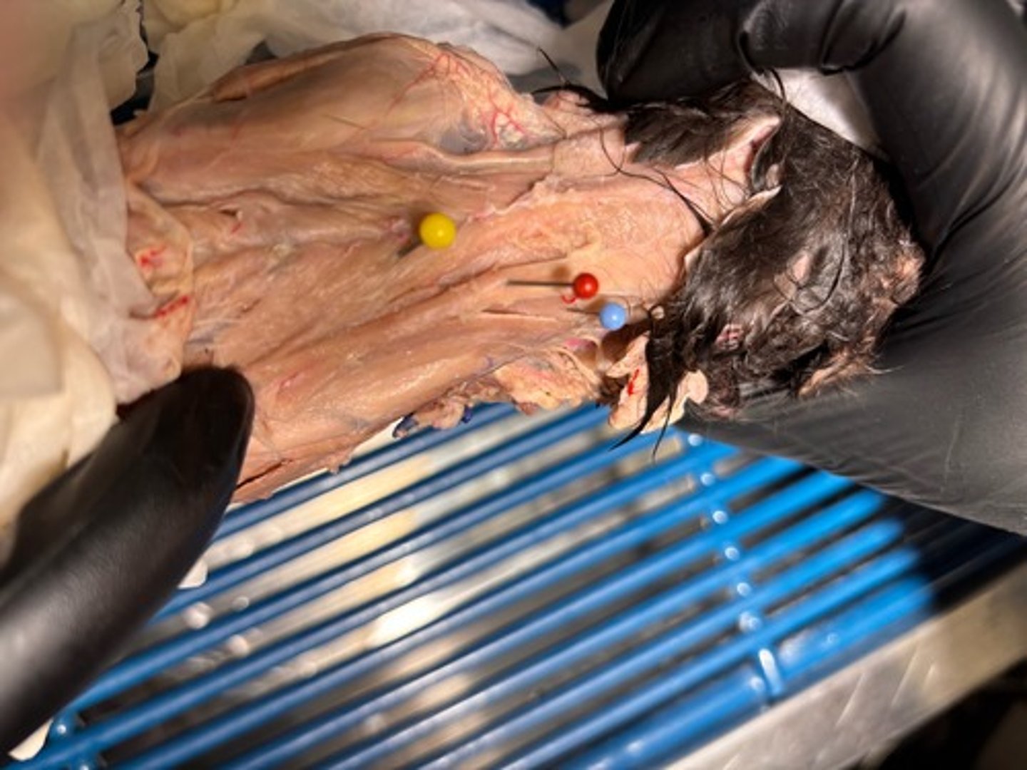 <p>What muscle of the neck is the light blue pin in</p>