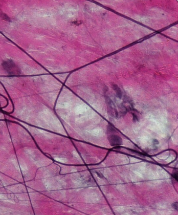 <p>connective tissue that:</p><ul><li><p>Support and bind other tissues</p></li><li><p>Hold body fluids</p></li><li><p>Defend against infections</p></li><li><p>Consist of <strong>fibroblasts, macrophages, fat cells, and occasional mast cells</strong></p></li><li><p>Typical arrangement is that of loose fibers forming “empty spaces”: a</p><p>reservoir of fluid</p></li><li><p>High hyaluronic acid content</p></li><li><p>Retains water seen in edema</p></li></ul><p></p><p></p>