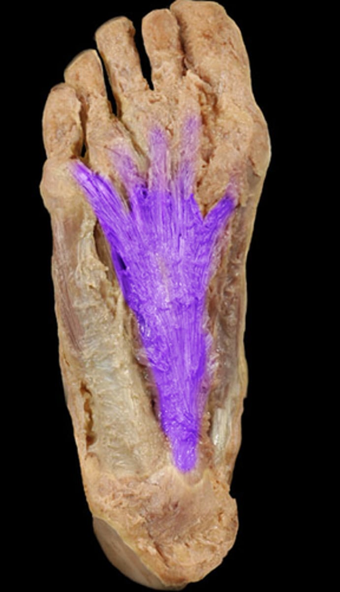 <p>Proximal attachment: Extends between phalanges of the foot and calcanus</p><p>Distal attachment:</p><p>Comments, Applications and Relationships: Thick connective tissue formed from deep fascia of the foot. Helpful hint- directly overlies the flexor digitorum brevis muscle. inflammation of this m. is called plantar fasciitis.</p><p>Action: Flexor of the toes.</p>