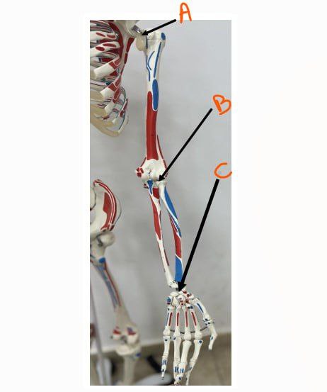 <p>Identify the joints in this picture and classify them</p>