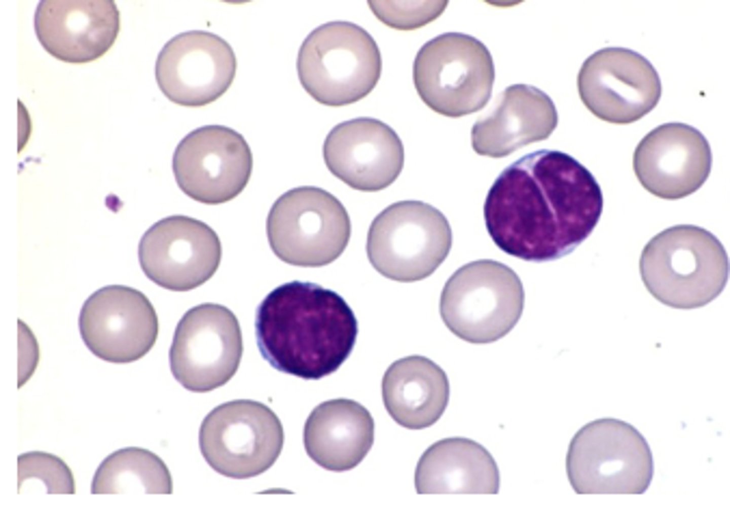 <p>lymphocytosis indicating</p>