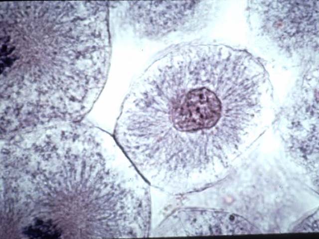 <p>Is this a phase of mitosis, and which phase is it?</p>