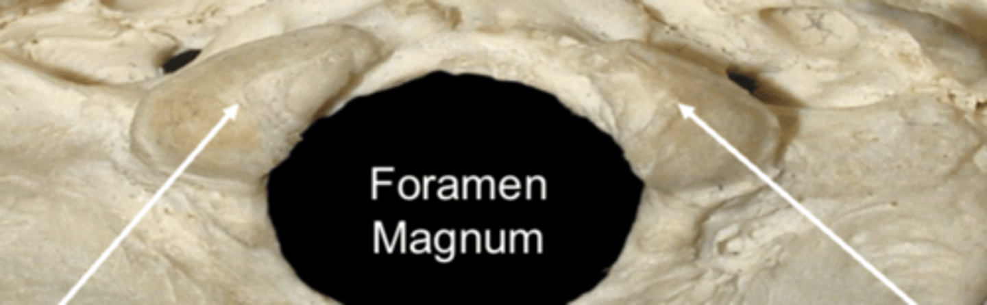 <p>occipital condyle</p>