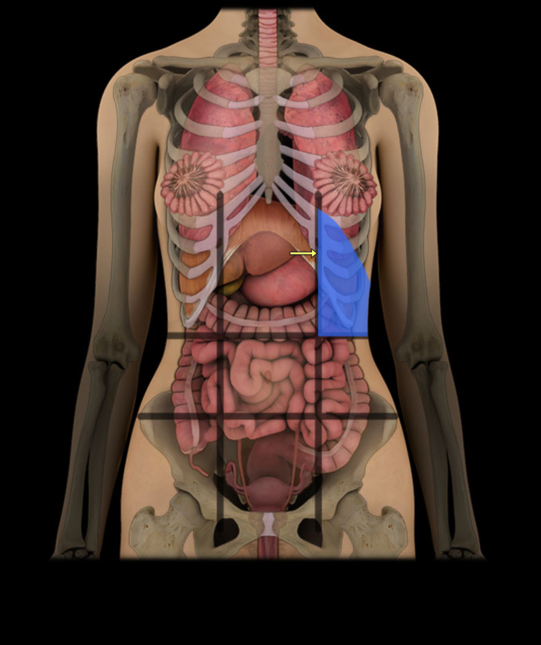<p><span style="color: red;"><strong>Upper left under ribs;</strong></span> <strong>contains spleen</strong></p>