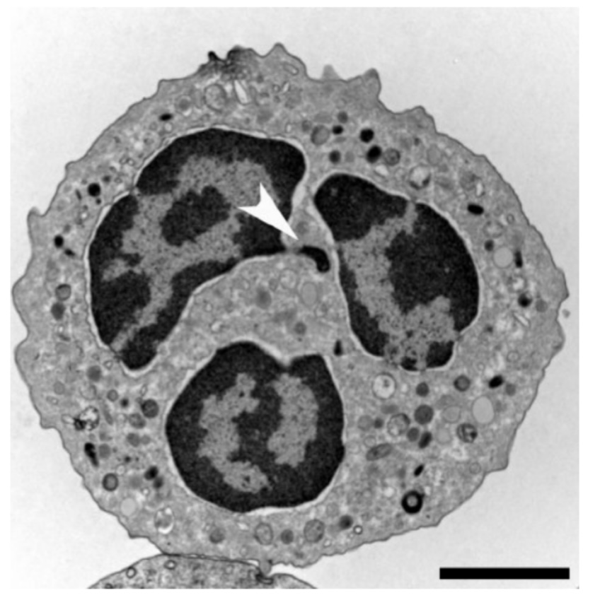 <p>A. ID the specific type of blood cell</p><p>B. What is the labeled structure? </p><p>C. Name contents of the granules within the cytoplasm? </p>