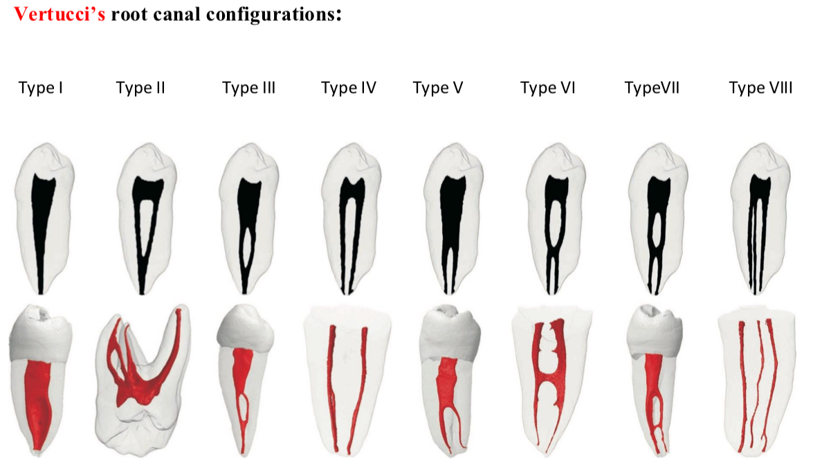 <p><span>Vertucci- 8 types </span></p><p><span>Weine- 4 </span></p>