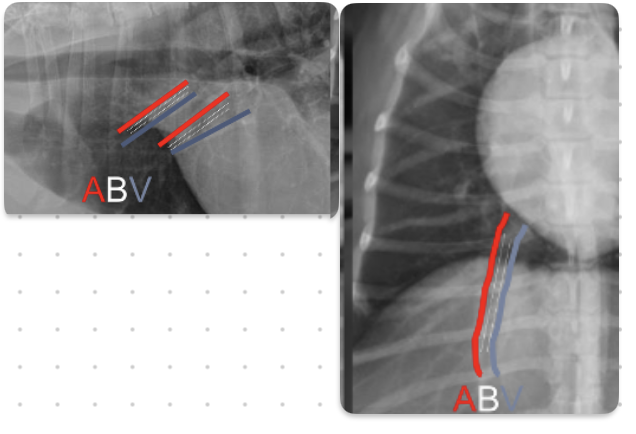 <p>ABV</p><p>-veins are ventral and central</p><p>-arteries are dorsal and peripheral</p>