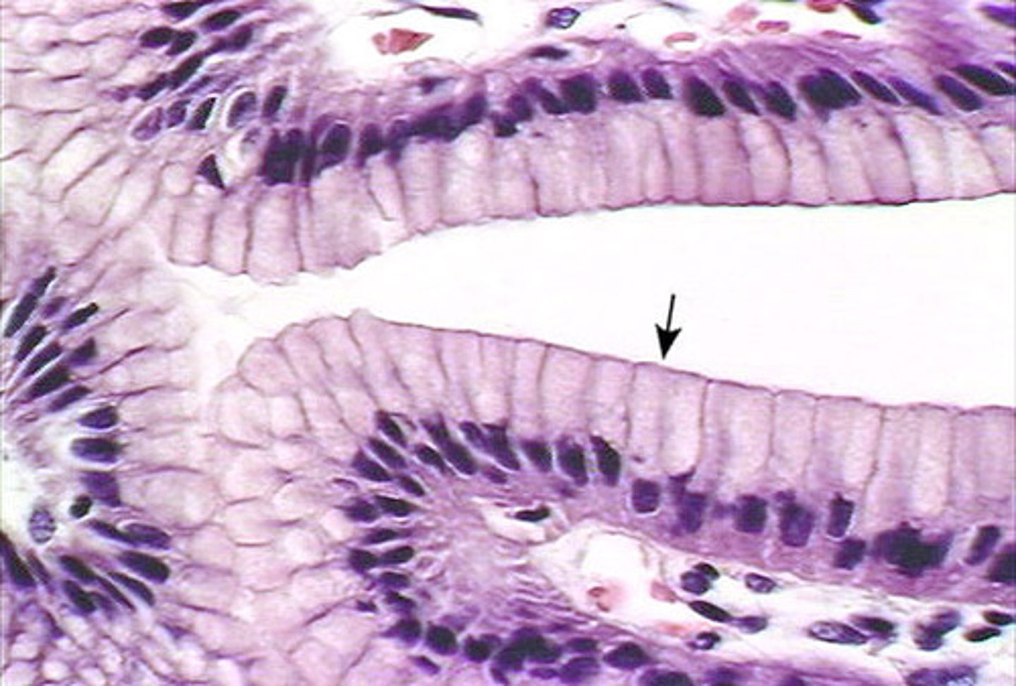 <p>The nuclei of simple columnar epithelium are all at the same level, near the basal surface. Absorption, secretion, and protection. - Cilia, Microvilli, Goblet cells, Stereocilia.</p>