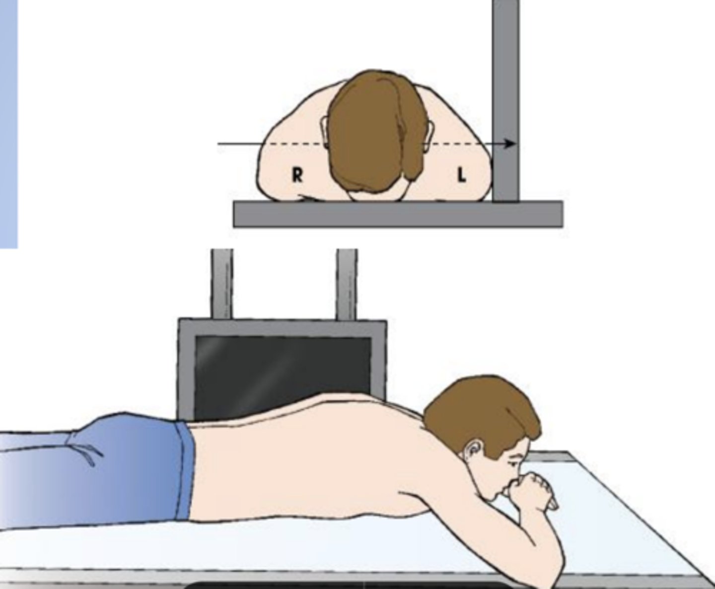 <p>radiographic position of the abdomen results in a left lateral projection. Note the horizontal orientation of the central ray</p>