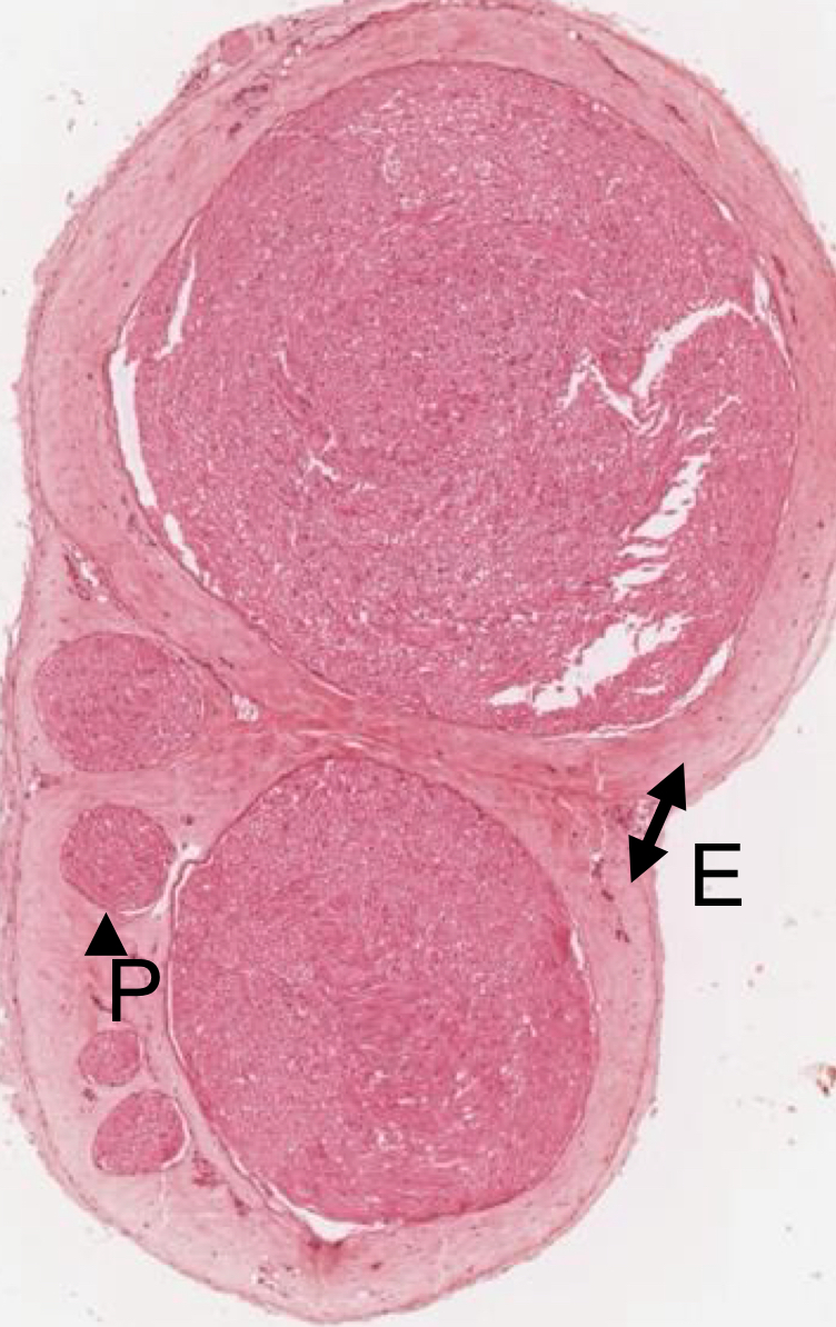 <p>6 nerve bindles in this cross section of a nerve</p>
