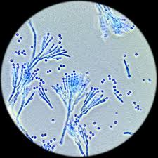 <p>Which fungi is this? </p>