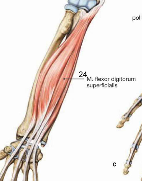 <p>m.flexor digitorum superficialis</p>