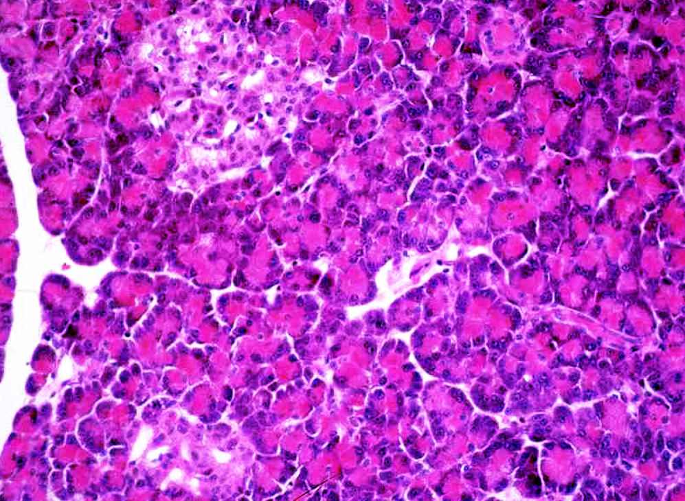<p><span style="font-size: large">Observe the histological pattern of this specimen and select the correct identification from the list.</span></p><p><span style="font-size: large">a) adrenal gland</span></p><p><span style="font-size: large">b) thyroid gland</span></p><p><span style="font-size: large">c) pituitary gland</span></p><p><span style="font-size: large">d) parathyroid gland</span></p><p><span style="font-size: large">e) pancreas</span></p>