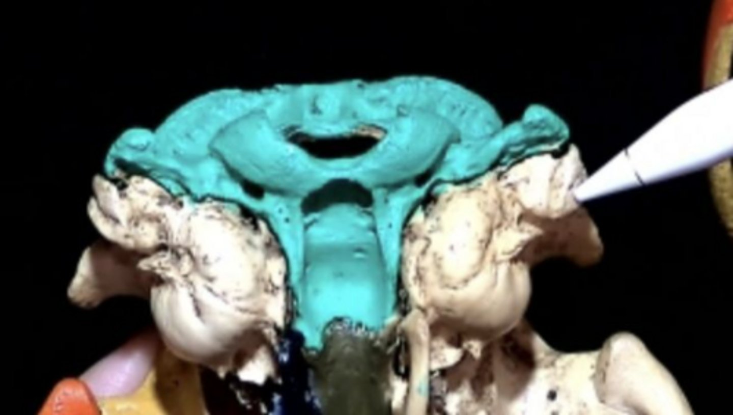 <p>Projection of the temporal bone</p>