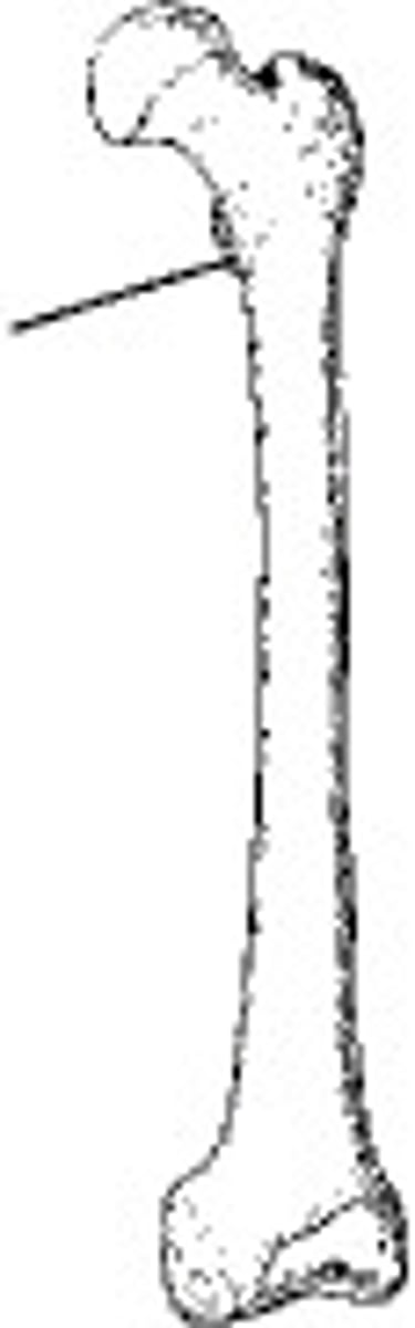 <p>lesser trochanter</p>