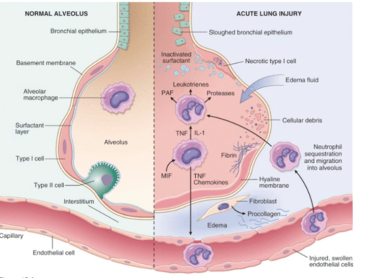 Robbins Ch 15: Lung Flashcards | Knowt