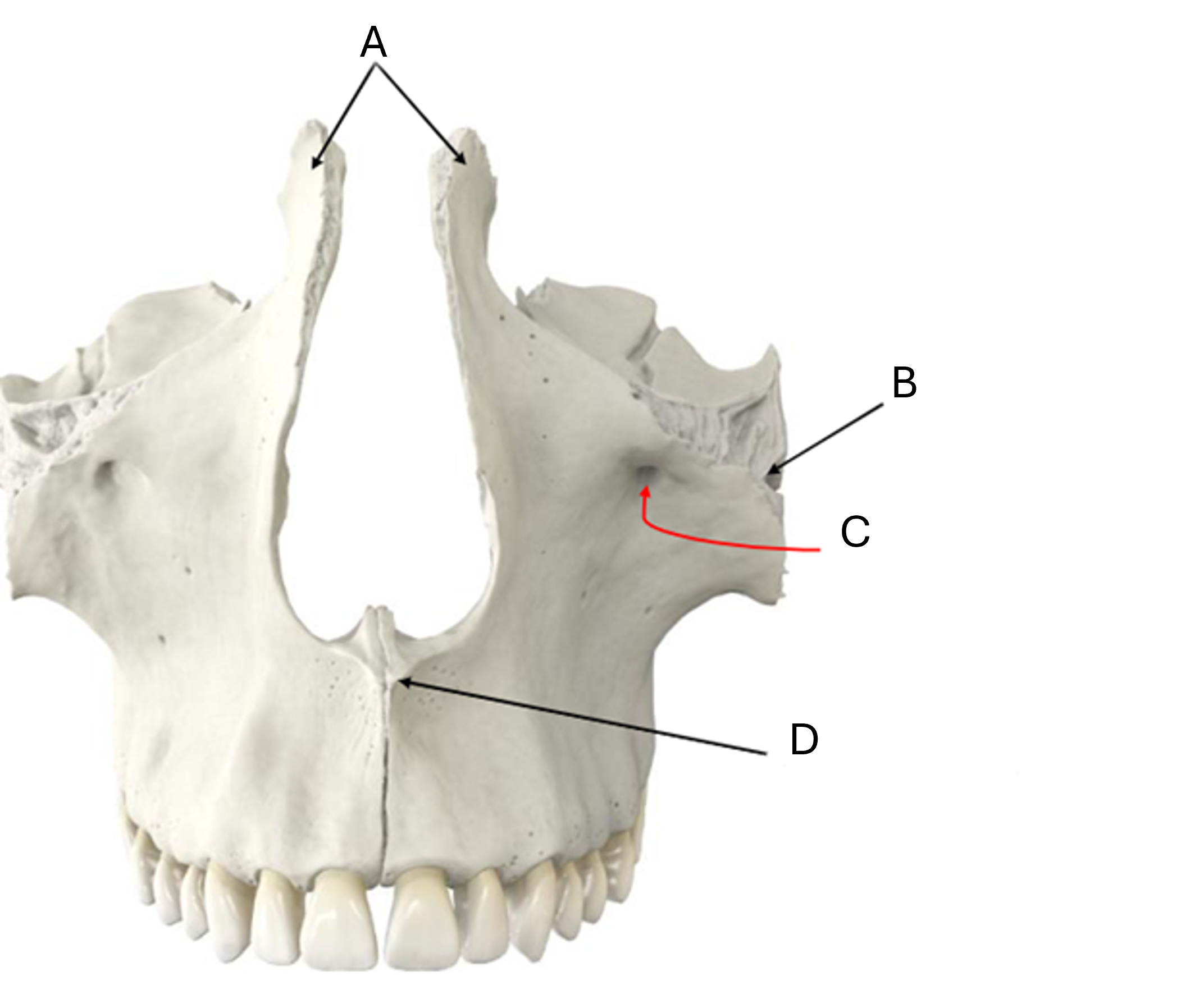 term image